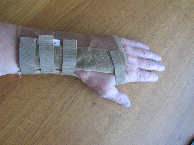 WristSplintBack.JPG